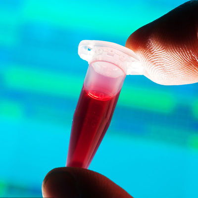 Одобренное Управлением по санитарному надзору за качеством пищевых продуктов и медикаментов обслуживание удостоверения подлинности третьей стороны бутылки младенца контакта еды обнаружения испытательных лабораторий быстрое