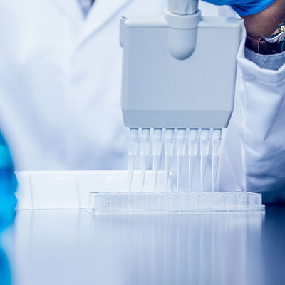 Качественное обслуживание удостоверения подлинности третьей стороны по проверке лаборатории Sgs аттестации NEMKO лаборатории УПРАВЛЕНИЯ ПО САНИТАРНОМУ НАДЗОРУ ЗА КАЧЕСТВОМ ПИЩЕВЫХ ПРОДУКТОВ И МЕДИКАМЕНТОВ